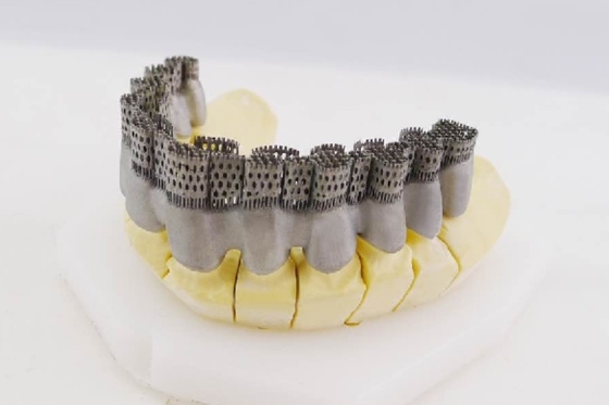 Принтер крон и Dentures 3D лазера цифров 20-60μM волокна зубоврачебного принтера FCC 3D двойной