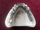 Печатание Denture стопа принтера одного титана 3D сплава хромия кобальта зубоврачебное