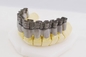 кронштейнов кроны 20μM свет принтера 3D высокоскоростных медицинский леча для зубоврачевания